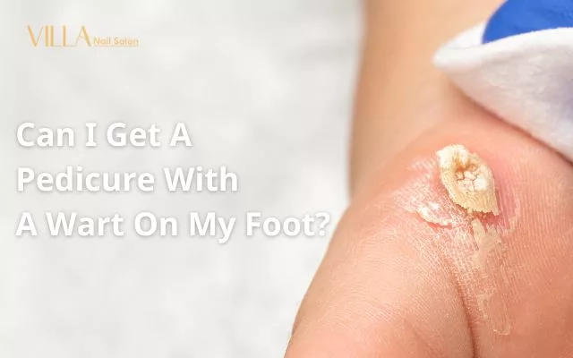 Can I Get A Pedicure With A Wart On My Foot?
