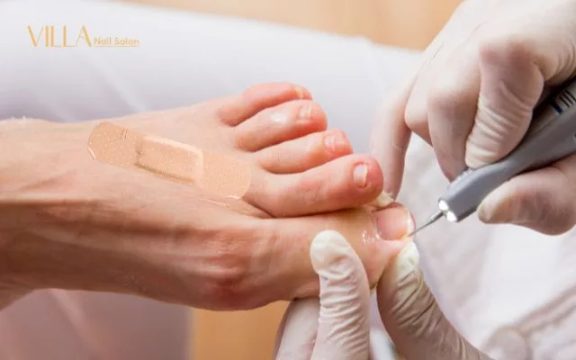 Different Pedicure Types with a Bandaid