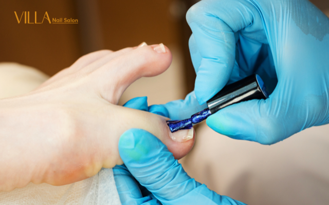 Do Nail Salons Judge Your Gross Feet?